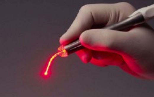 laser